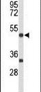 Myocyte Enhancer Factor 2A antibody, PA5-26266, Invitrogen Antibodies, Western Blot image 