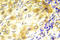 p53 antibody, AP20989PU-N, Origene, Immunohistochemistry paraffin image 