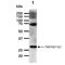 TNF Receptor Superfamily Member 10c antibody, GTX57733, GeneTex, Western Blot image 