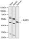 GA Binding Protein Transcription Factor Subunit Alpha antibody, 14-357, ProSci, Western Blot image 
