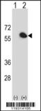 Peptidyl-prolyl cis-trans isomerase FKBP4 antibody, 62-872, ProSci, Western Blot image 