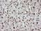 Tripartite Motif Containing 38 antibody, M10133, Boster Biological Technology, Immunohistochemistry paraffin image 