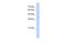 Fibronectin type III domain-containing protein 3B antibody, PA5-43419, Invitrogen Antibodies, Western Blot image 