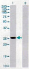 Phospholipase B Domain Containing 1 antibody, MBS646897, MyBioSource, Western Blot image 