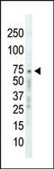 G Protein-Coupled Receptor Kinase 2 antibody, 62-582, ProSci, Western Blot image 