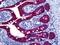 Keratin 6A antibody, orb94833, Biorbyt, Immunohistochemistry paraffin image 