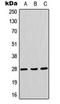 Aquaporin 1 (Colton Blood Group) antibody, orb216019, Biorbyt, Western Blot image 