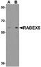 RAB Guanine Nucleotide Exchange Factor 1 antibody, A03937, Boster Biological Technology, Western Blot image 