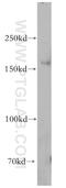 Histidine Rich Calcium Binding Protein antibody, 18142-1-AP, Proteintech Group, Western Blot image 