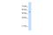 SHMT antibody, A03233, Boster Biological Technology, Western Blot image 