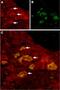 Transient Receptor Potential Cation Channel Subfamily V Member 6 antibody, PA5-77321, Invitrogen Antibodies, Immunohistochemistry paraffin image 