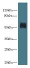 Glycerol Kinase 5 antibody, LS-C377844, Lifespan Biosciences, Western Blot image 