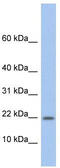 Norrin antibody, TA335136, Origene, Western Blot image 