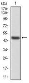 Transthyretin antibody, NBP2-52575, Novus Biologicals, Western Blot image 