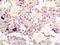 Succinate Dehydrogenase Complex Subunit C antibody, GTX60139, GeneTex, Immunohistochemistry paraffin image 