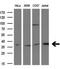 MCL1 Apoptosis Regulator, BCL2 Family Member antibody, GTX84135, GeneTex, Western Blot image 