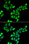 UDP-Galactose-4-Epimerase antibody, 22-339, ProSci, Immunofluorescence image 