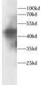 HNF1 Homeobox B antibody, FNab10705, FineTest, Western Blot image 