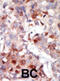 AKT Serine/Threonine Kinase 3 antibody, abx033131, Abbexa, Immunohistochemistry paraffin image 