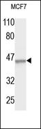 Keratin 18 antibody, 251733, Abbiotec, Western Blot image 