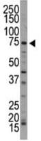 NUAK Family Kinase 1 antibody, ab71814, Abcam, Western Blot image 