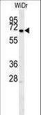 Meis Homeobox 2 antibody, LS-C164132, Lifespan Biosciences, Western Blot image 