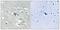 Fms Related Tyrosine Kinase 1 antibody, GTX55337, GeneTex, Immunohistochemistry paraffin image 
