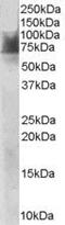 Solute Carrier Family 6 Member 4 antibody, PA5-18374, Invitrogen Antibodies, Western Blot image 