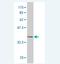 Phosphorylase Kinase Regulatory Subunit Beta antibody, H00005257-M02, Novus Biologicals, Western Blot image 