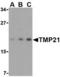 Transmembrane P24 Trafficking Protein 10 antibody, TA306376, Origene, Western Blot image 