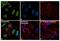 Nucleolin antibody, PA1-16919, Invitrogen Antibodies, Immunofluorescence image 