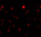 Zinc Finger E-Box Binding Homeobox 1 antibody, 5825, ProSci, Immunofluorescence image 