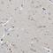 Serine Protease 12 antibody, PA5-57132, Invitrogen Antibodies, Immunohistochemistry frozen image 