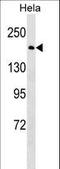 BRCA1 DNA Repair Associated antibody, LS-C156856, Lifespan Biosciences, Western Blot image 