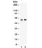 Chaperonin Containing TCP1 Subunit 5 antibody, R32402, NSJ Bioreagents, Western Blot image 