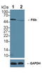 Fibrinogen Beta Chain antibody, LS-C294158, Lifespan Biosciences, Western Blot image 