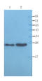 Alpha-1-acid glycoprotein antibody, orb339608, Biorbyt, Western Blot image 