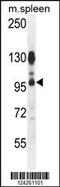 ArfGAP With Coiled-Coil, Ankyrin Repeat And PH Domains 1 antibody, 55-658, ProSci, Western Blot image 