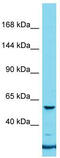 NBPF Member 11 antibody, TA337462, Origene, Western Blot image 