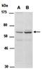 Methyl-CpG Binding Protein 2 antibody, orb66904, Biorbyt, Western Blot image 