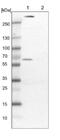 Phosphoglucomutase 1 antibody, NBP1-85982, Novus Biologicals, Western Blot image 