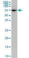 Plastin 1 antibody, LS-C197926, Lifespan Biosciences, Western Blot image 