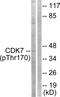 Cyclin Dependent Kinase 7 antibody, PA5-38452, Invitrogen Antibodies, Western Blot image 