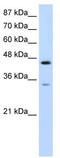 Splicing Factor 3b Subunit 4 antibody, TA345932, Origene, Western Blot image 