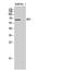 NADP-dependent malic enzyme, mitochondrial antibody, STJ94060, St John