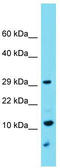 Distal Membrane Arm Assembly Complex 1 antibody, TA333580, Origene, Western Blot image 