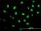 Zinc finger FYVE domain-containing protein 19 antibody, H00084936-M01, Novus Biologicals, Immunocytochemistry image 