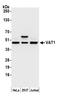 Vesicle Amine Transport 1 antibody, A305-561A, Bethyl Labs, Western Blot image 