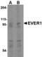 Transmembrane Channel Like 6 antibody, MBS151500, MyBioSource, Western Blot image 