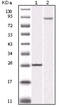 Inhibitor Of Nuclear Factor Kappa B Kinase Subunit Beta antibody, abx010971, Abbexa, Enzyme Linked Immunosorbent Assay image 